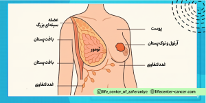 بخش های مختلف پستان و تومور پستان